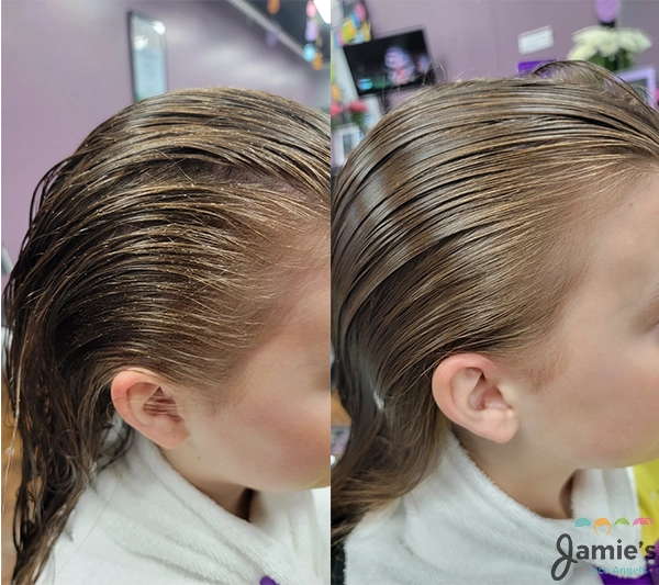 A side by side image of a girl with head lice on the left and the same girl on the right with no head lice.