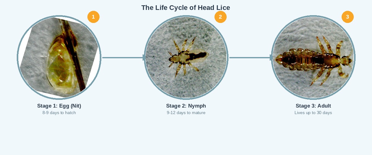 The life cycle of head lice showing egg, nymph, and adult stages