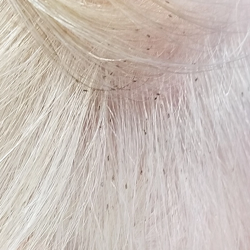 Nits attached to blonde hair shafts — close-up photo