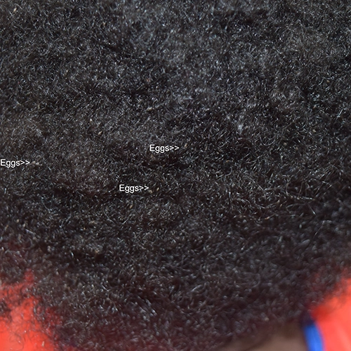 Nits in curly brown hair — close-up photo